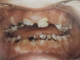 Παιδοδοντίατρος Βίκυ Ορ. Τασιούλα Οδοντίατρος Α.Π.Θ., ειδικευθείσα στην Παιδοδοντιατρική M Dent Sci Leeds Dental Institute, UK | Οδοντίατρος για παιδιά, εφήβους και ειδικούς ασθενείς | Πάροδος Γ. Ολυμπίου 1, 60132 Κατερίνη | Παιδοδοντίατρος στην Κατερίνη, Οδοντίατρος για παιδιά στην Κατερίνη, paidodontiatros katerini